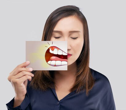Can’t Stop Bleeding from Your Gums? Here’s What to Do