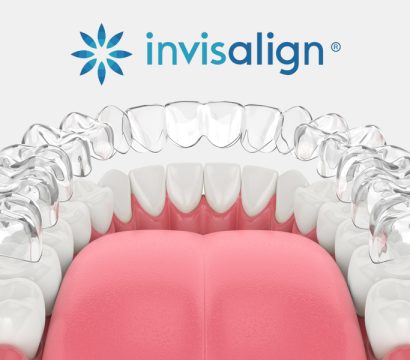 What to Expect from an Invisalign Dentist in 21043 for Smile Correction