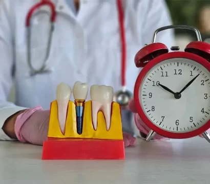 What Is the Recovery Time After Treatment by Implant Dentists?