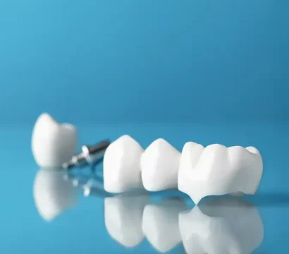 The Latest Advancements in Dental Crown Technology in Ellicott City