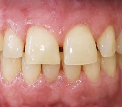 Cosmetic Dentistry Services