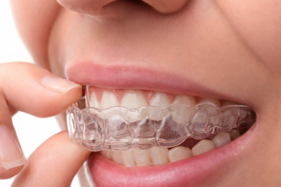 Teeth whitening ellicott city