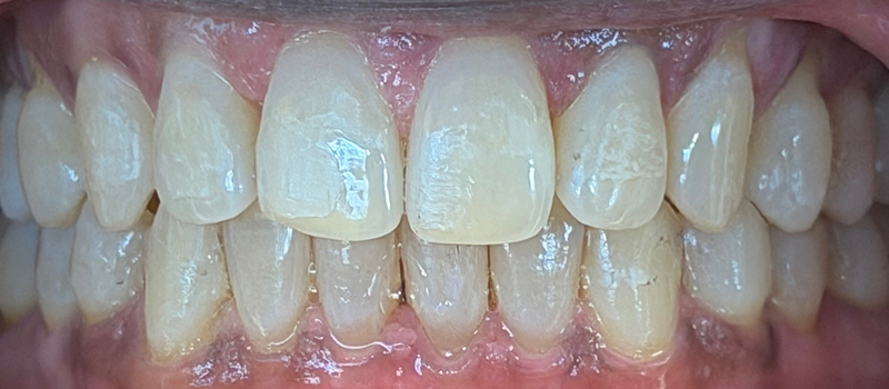 After image