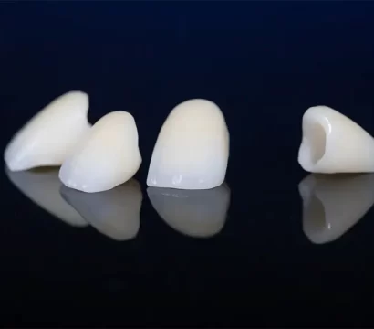 Dental Crowns vs Dental Bridges: Which Option Is Better for You?