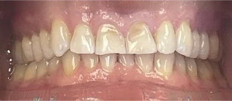 Before image